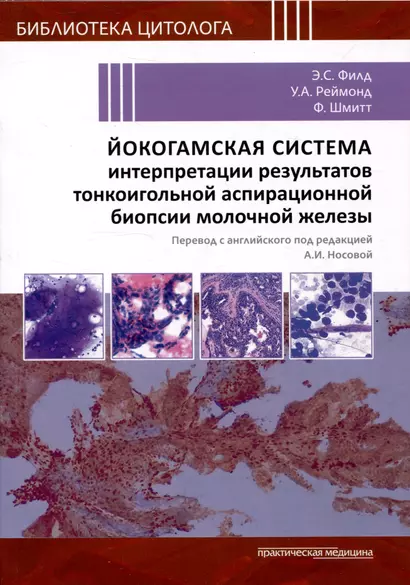 Йокогамская система интерпретации результатов тонкоигольной аспирационной биопсии молочной железы - фото 1