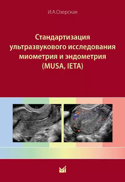 Стандартизация ультразвукового исследования миометрия и эндометрия (MUSA, IETA) - фото 1