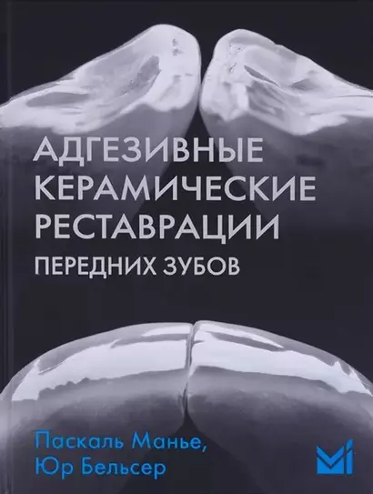 Адгезивные керамические реставрации передних зубов - фото 1