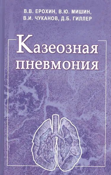 Казеозная пневмония. Руководство для врачей - фото 1