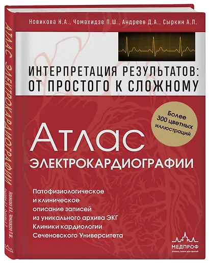 Атлас электрокардиографии. Интерпретация результатов: от простого к сложному - фото 3