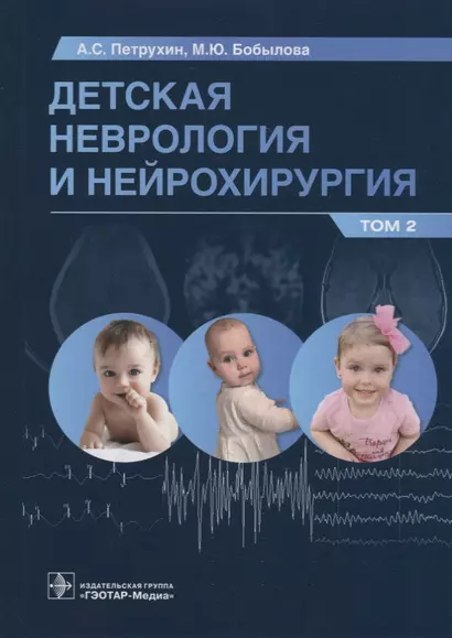 Детская неврология и нейрохирургия: учебник: в 2-х томах. Том 2 - фото 1