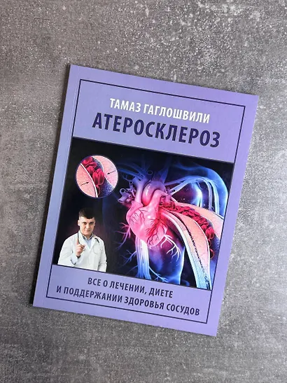 Атеросклероз. Все о лечении, диете и поддержании здоровья сосудов - фото 12