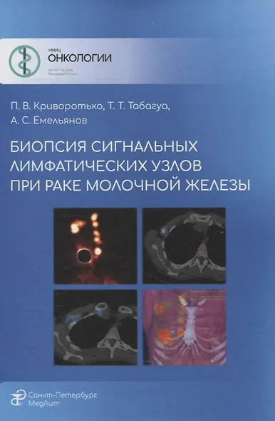 Биопсия сигнальных лимфатических узлов при раке молочной железы - фото 1