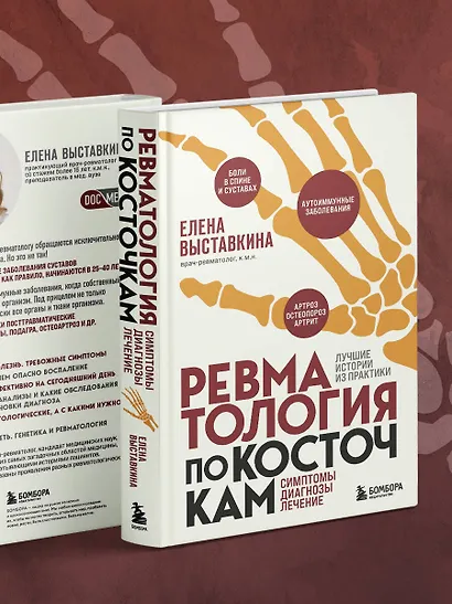 Ревматология по косточкам. Симптомы, диагнозы, лечение - фото 12