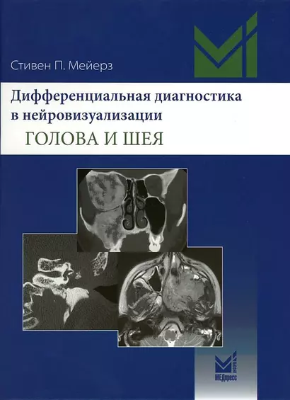 Дифференциальная диагностика в нейровизуализации. Голова и шея - фото 1