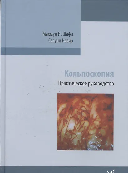 Кольпоскопия. - фото 1