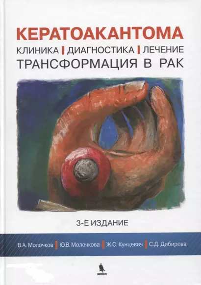 Кератоакантома. Клиника, диагностика, лечение, трансформация в рак. 3-е издание - фото 1