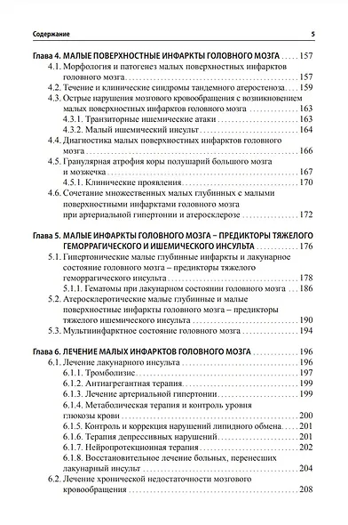 Малые инфаркты головного мозга - фото 4