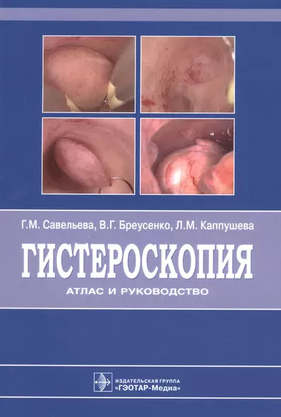 Гистероскопия : атлас и руководство. 2-е издание, дополненное и переработанное - фото 1