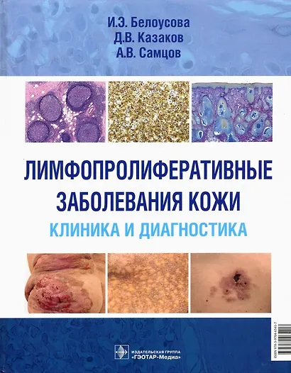 Лимфопролиферативные заболевания кожи. Клиника и диагностика - фото 1