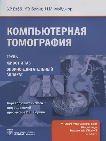 Компьютерная томография. - фото 1