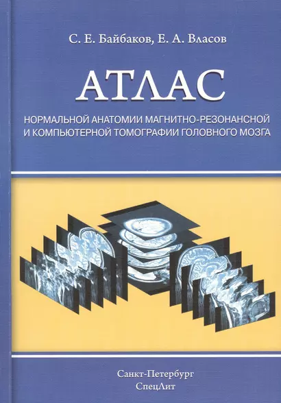 Атлас нормальной анатомии магнитно-резонансной и компьютерной томографии головного мозга : уебное пособие - фото 1