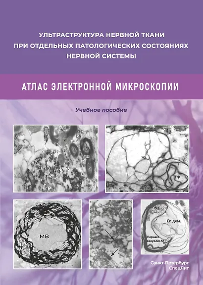Ульстраструктура нервной ткани при отдельных патологических состояниях нервной системы. Атлас  электронной микроскопии. - фото 1