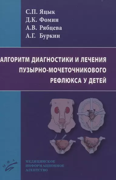 Алгоритм диагностики и лечения пузырно-мочеточникового рефлюкса у детей - фото 1