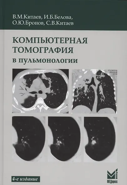 Компьютерная томография в пульмонологии - фото 3