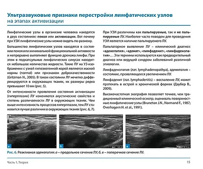 Лимфатические узлы в ультразвуковой диагностике - фото 6