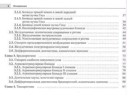 Электрокардиограмма: основы дифференциальной диагностики - фото 3
