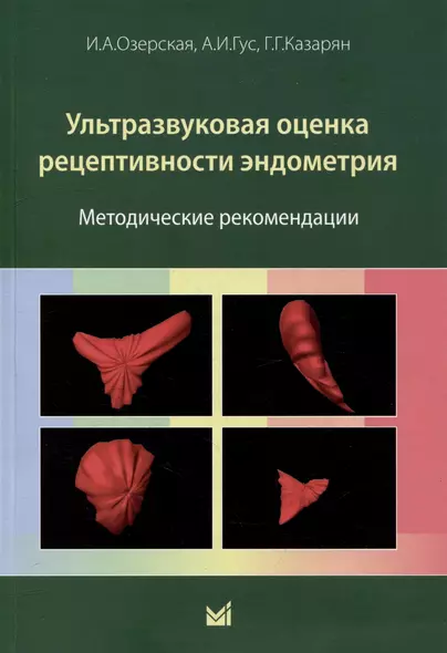 Ультразвуковая оценка рецептивности эндометрия: методические рекомендации - фото 1