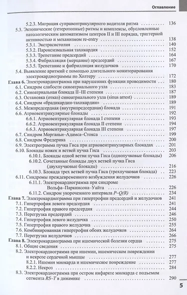 Электрокардиография - фото 4