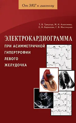 Электрокардиограмма при асимметричной гипертрофии левого желудочка / (мягк) (От ЭКГ к диагнозу). Трешкур Т. и др. (Диля) - фото 1