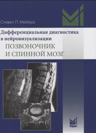 Дифференциальная диагностика в нейровизуализации. Позвоночник и спинной мозг - фото 1