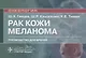 Рак кожи. Меланома - фото 1