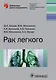 Рак легкого - фото 1