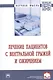Лечение пациентов с вентральной грыжей и ожирением: монография - фото 1