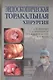Эндоскопическая торакальная хирургия. Руководство для врачей - фото 1