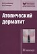 Атопический дерматит - фото 1