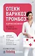 Отеки, варикоз, тромбоз и другие болезни вен. Как лечить и предотвратить - фото 1