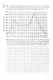 ВПР. Математика. 8 класс. Типовые задания. 15 вариантов заданий. Подробные критерии оценивания. Ответы - фото 4