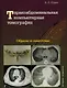 Торакоабдоминальная компьютерная томография. Образы и симптомы - фото 1
