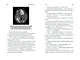 Потерявшая разум: Откровенная история нейроученого о болезни, надежде и возвращении - фото 3