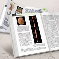 Анатомические поезда - фото 12