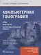 Компьютерная томография. - фото 1