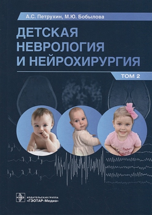 Детская Неврология И Нейрохирургия: Учебник: В 2-Х Томах. Том 2.