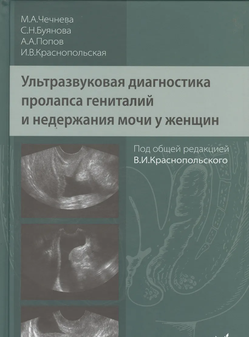 мочеиспускание　женщина 